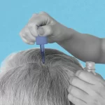 Wigs for Hair Loss: What to Know Before Buying